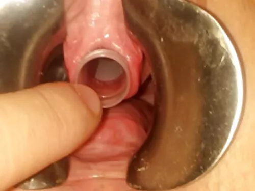 Омъжена брюнетка, сл ...